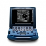 SonoSite MICROMAXX Ultrasound