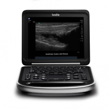 (English) SonoSite EDGE Ultrasound