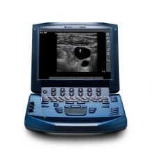 (English) SonoSite MICROMAXX Ultrasound